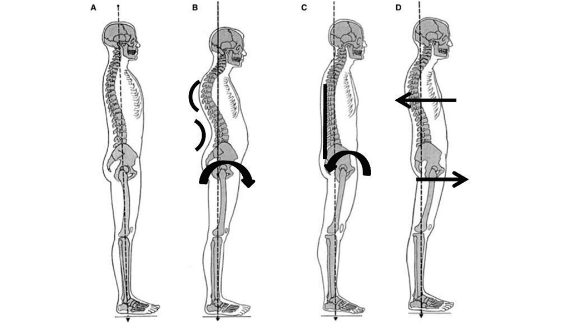 tipos de postura