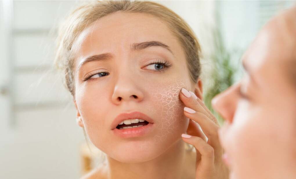 Las cremas hidratantes faciales ayudan a una piel seca porque esto le sumará suavidad y lubricación natural de tu piel.