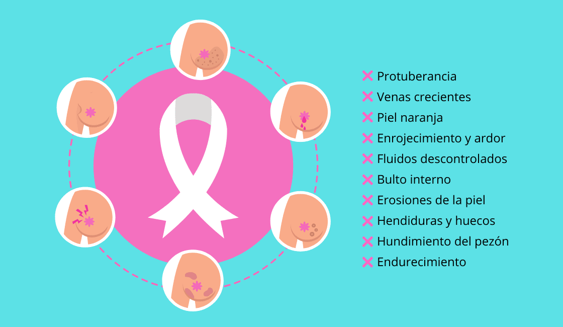 qué es el cáncer de mama